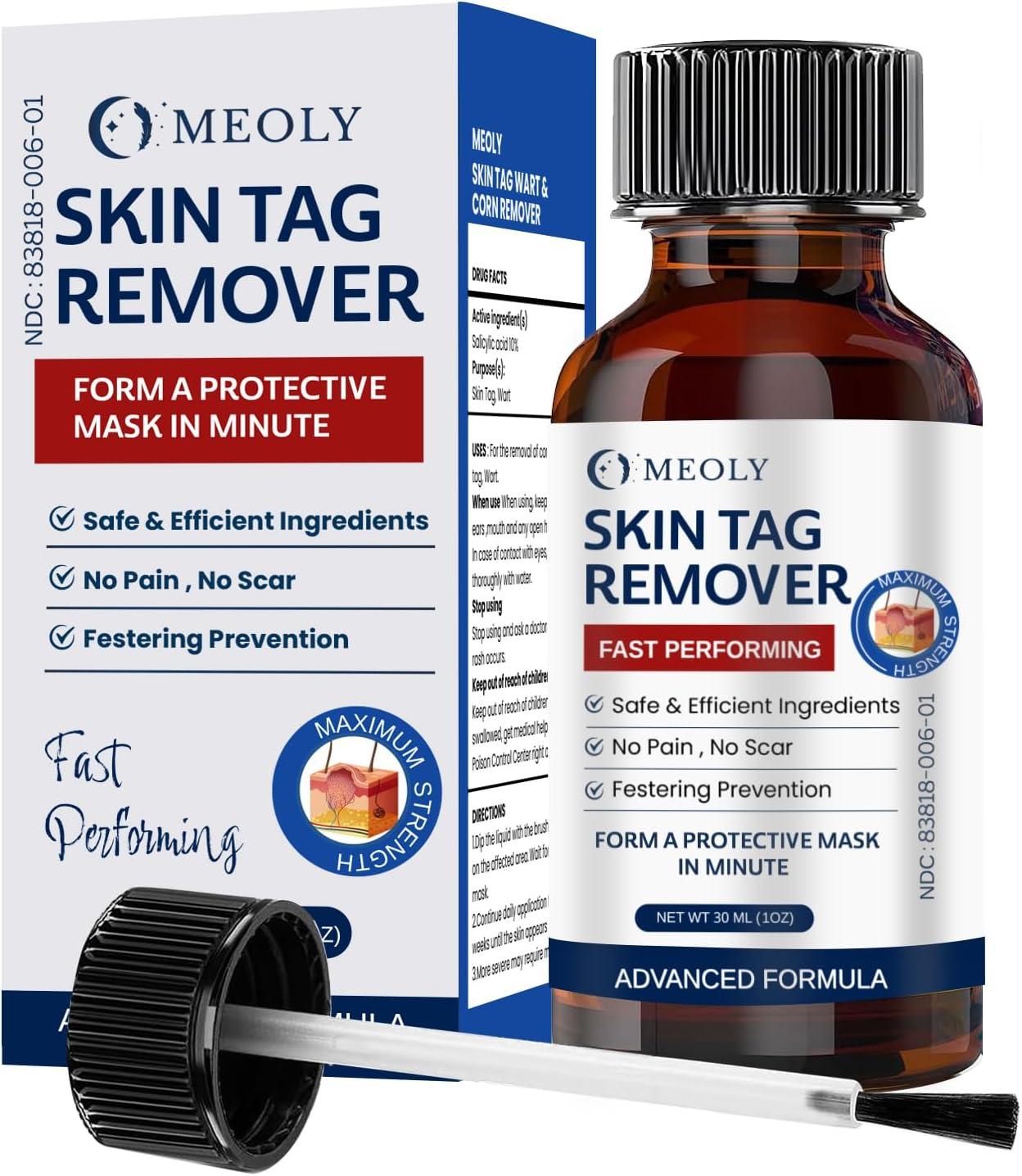 Surprising Insight: Fast-Acting Salicylic Acid Remover Versus Skin Tags… Get Ready To Be Tested!